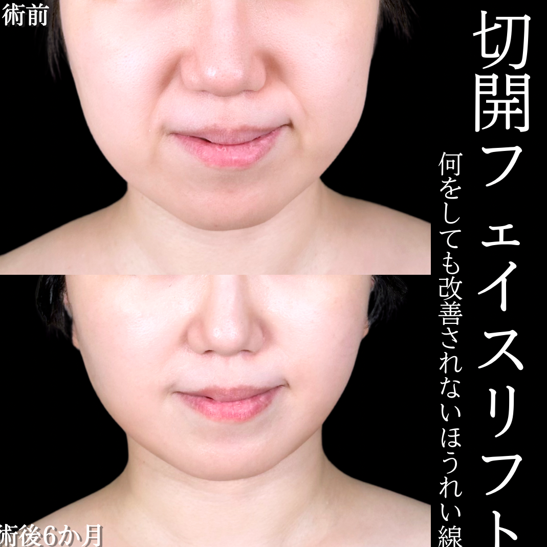 No.15797の症例写真